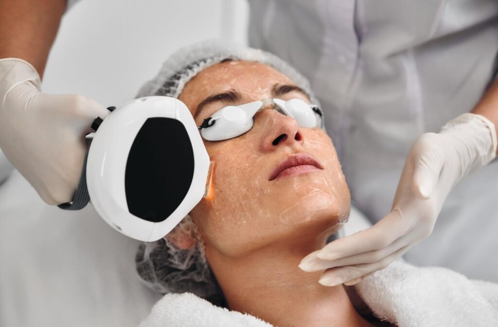 Patient undergoing Intense Pulsed Light (IPL) therapy with protective eyewear, a common treatment for dry eye related to meibomian gland dysfunction (MGD)