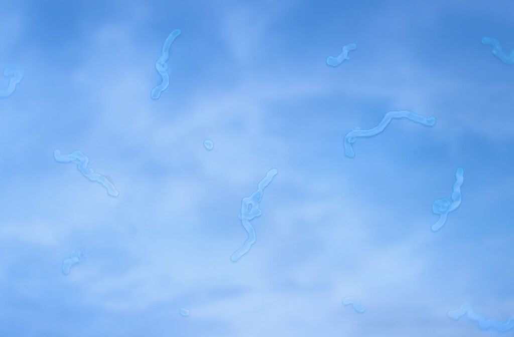 Visual representation of eye floaters appearing against a blue sky background.
